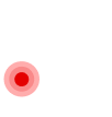Ankle Pain and Instability