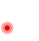 Ankle Instability Surgery / Reconstruction