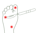 Wart Curettage