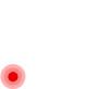 Surgery for Plantar Fasciitis